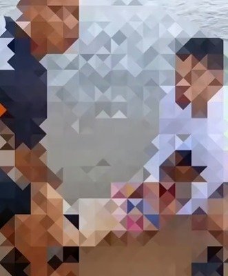 Jovem de 19 anos é atacada por tubarão na Praia de Boa Viagem e perde perna no Recife