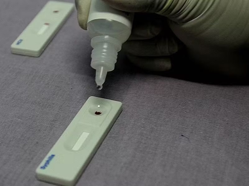 Situação de epidemia de sífilis no Estado do Rio acende alerta em Macaé e Rio das Ostras